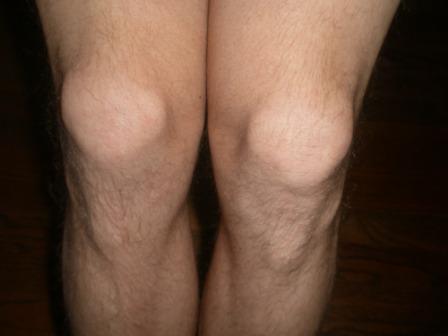 knee hurts